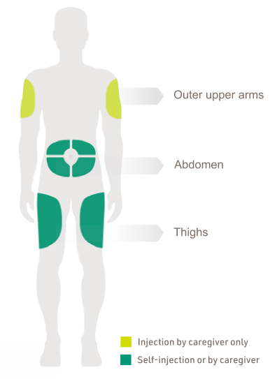 Showing that DUPIXENT can be injected into the outer upper arms, the abdomen (except for the 2 inches (5 cm) around the navel), and the thighs. Only a caregiver can inject into the outer upper arms.