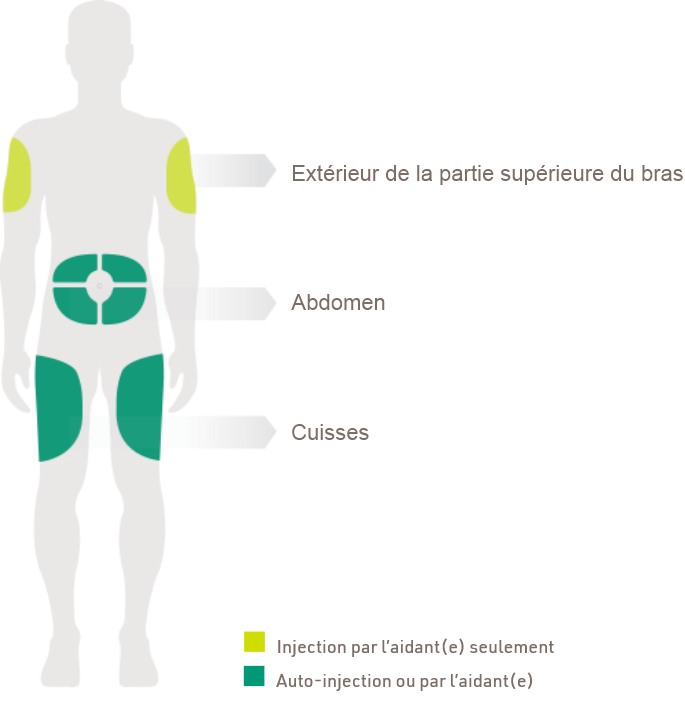 DUPIXENT peut être injecté dans l’extérieur de la partie supérieur du bras, dans l’abdomen (sauf dans un rayon de 5 cm [2 pouces] autour du nombril) et dans les cuisses. L’injection dans l’extérieur de la partie supérieure du bras peut être faite seulement par l’aidant/e.